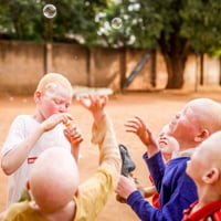 Spotlight: Christopher Beauchamp on Albinism & East Africa